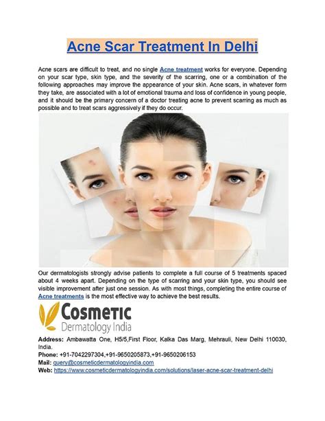 Best Acne Scar Treatment In Delhi Digital Art By Cosmetic Dermatology