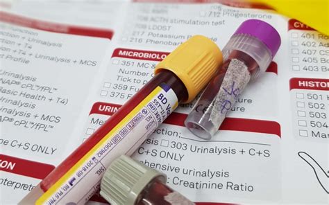 The Importance Of Blood Testing Brandon Park Veterinary Hospital