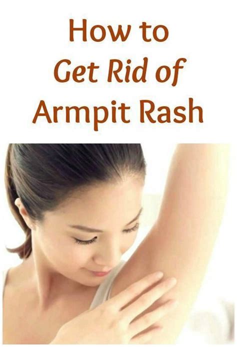 You Can Heal Armpit Rash With Home Remedies If You Are Confident As To Its Cause But It Should