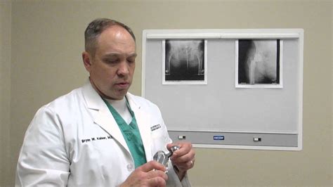 What To Expect From Your Hip Replacement Dr Bryan Kaiser Youtube