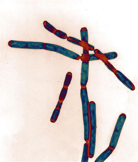 Anthrax Bacillus Photograph By Meckesottawa Fine Art America