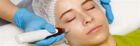 Dermapen Somerset Cosmetic Clinic