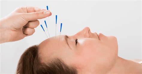 How Much Does Acupuncture Cost Dr Anne Marie Nguyen Best Acupuncture Clinic Best