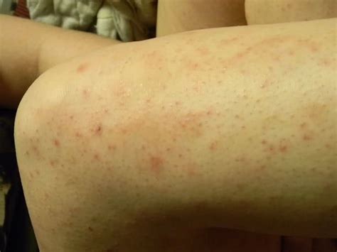 We did not find results for: Get rid of that razor burn today. http://www.sallapom.com ...