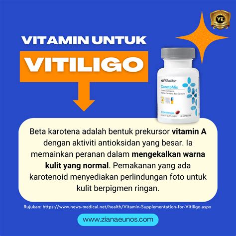 Penyakit Sopak Atau Vitiligo Cara Terbaik Dan Selamat Untuk Merawat