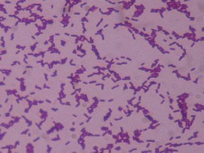 The gram stain result becomes variable as the culture ages. Bug Blog: June 2011