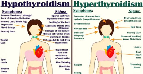 Often, cancer does not cause pain, so do not wait to feel pain before seeing a doctor. Everything You Need to Know About Every Thyroid Disorder ...