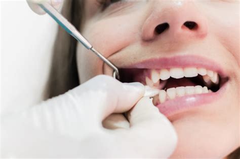Generally, you only need to leave the gauze in place as long as the site is actively oozing or bleeding. Tooth Extraction in Miami, FL | Dr. John Paul Gallardo