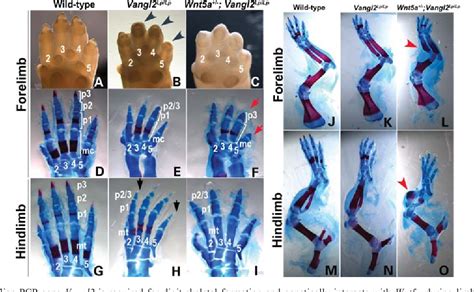 Figure 1 From Disruption Of Pcp Signaling Causes Limb Morphogenesis And
