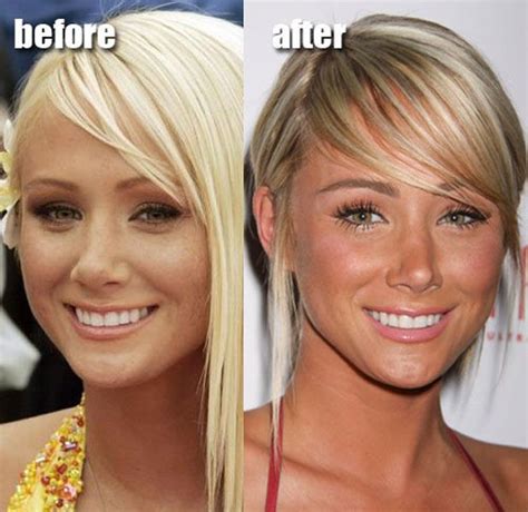 Sara Underwood Plastic Surgery Before And After Celebrity Plastic