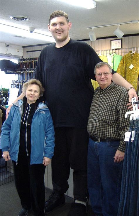 Tallest Man In America Igor Vovkovinskiy Dies At 38