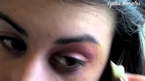 Black Eye Bruise Tutorial Youtube