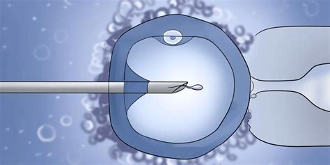 Intracytoplasmic Sperm Injection Telegraph
