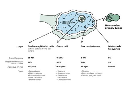 Cáncer De Ovario ¿qué El Cáncer De Ovario PortalclÍnic