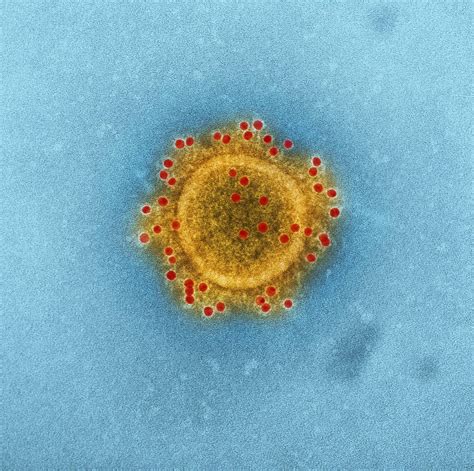 New Image Shows Colorized Coronavirus Particles Under A Microscope