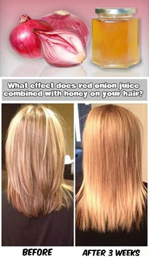 Hair Mask With Honey And Onion Juice For Hair Growth Our Motivations