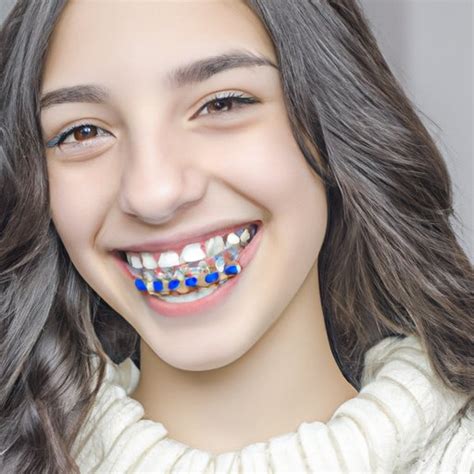 How Much Does Braces Cost With Insurance The Enlightened Mindset