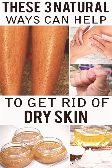 How To Remove Dry Skin On Legs And Hands At Home Normally Dry Skin