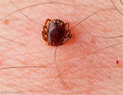 Along with mites, they constitute the subclass acari. Natural Tick Removal Solution - Yay or Nay? - Montana ...