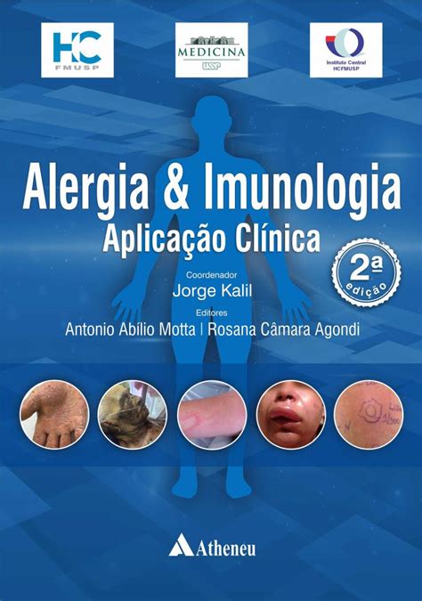 Alergia E Imunologia Aplicação Clínica