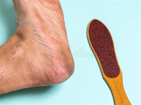Brush For Removing Rough Skin And The Man`s Left Leg Stock Image