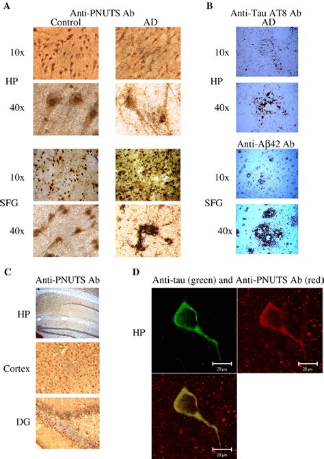 A Immunohistochemistry Staining Of Human Brain Sections From Hp And