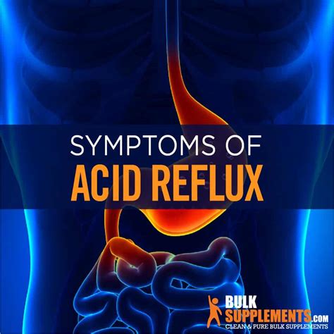 Acid Reflux And Gerd Diet Medicine And Remedy