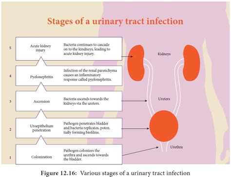 Urinary Tract Infections Medical Microbiology Free Download Nude Photo Gallery