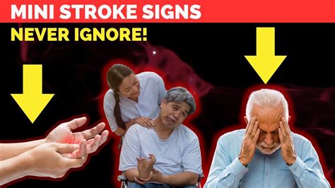7 Signs Of Mini Stroke Tia You Should Not Ignore Transient Ischemic