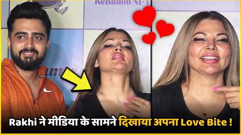 Drama Queen Rakhi Sawant Flaunted Her Love Bite In Front Of The Media Youtube