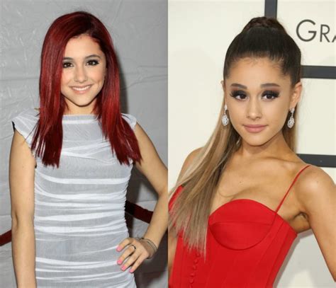 Ariana Grande Plastic Surgery Then And Now Compared Luv68
