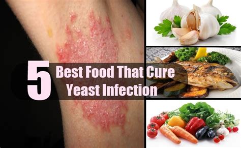 Herbal Remedies For Yeast Infections 5 Effective Ways To Get Rid Of