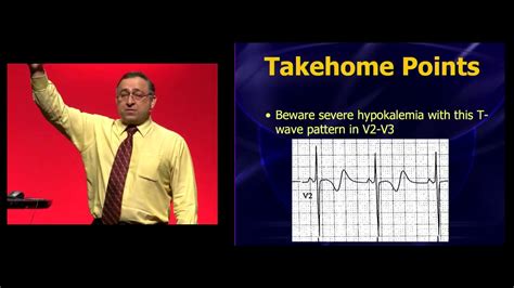 Eem 2019 Hypokalemia You Thought You Knew How To Recognize It Youtube