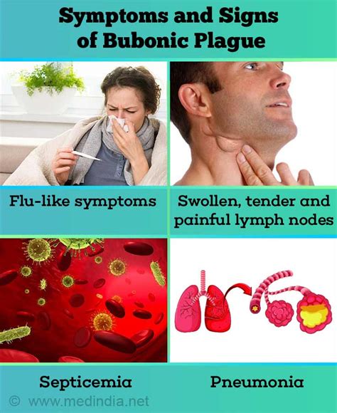 Bubonic Plague Causes Symptoms Diagnosis And Prevention