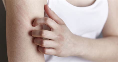 Itchy Rash In Crease Of Elbow Elbow Rash Symptoms Causes Treatments
