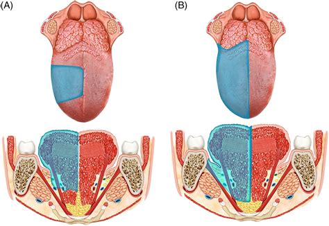 Base Of Tongue Anatomy Anatomy Book