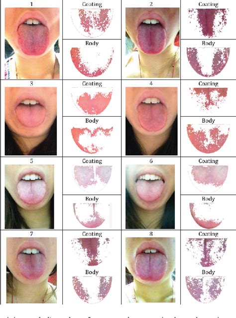 Pdf Tonguedx A Tongue Diagnosis System For Personal Health Care On