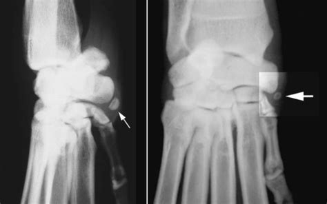 Radiographic Signs Of Joint Disease In Dogs And Cats Veterian Key