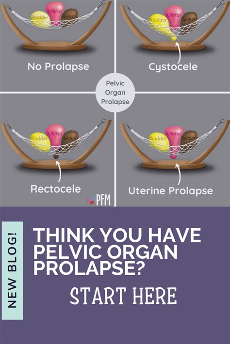 4 Things To Do If You Think You Have Pelvic Organ Prolapse Pelvic Organ Prolapse Uterine