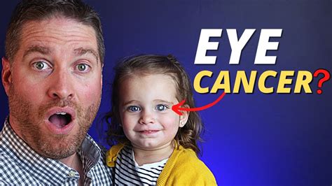 Retinoblastoma Eye Cancer In Children And How To Catch It With The