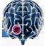 Brain Tumors Signs And Treatments  Houston Neurosurgery & Spine