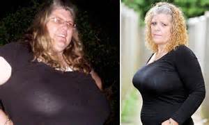 Mother Who Had M Size Chest Is Refused Nhs Breast Reduction Op