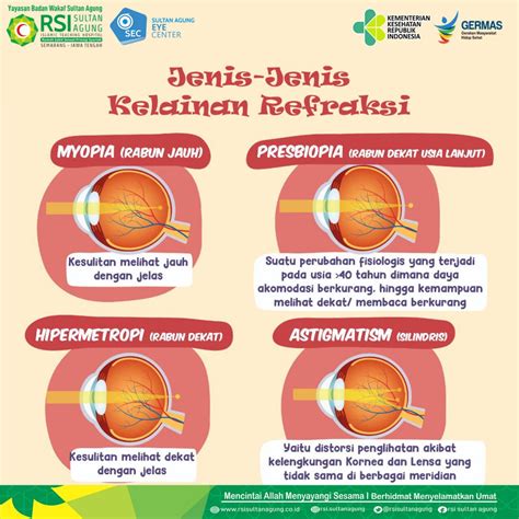 Sultan Agung Eye Center Yuk Kita Kenali Jenis Jenis Kelainan Refraksi