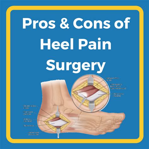 Pros And Cons Of Heel Pain Surgery Heel That Pain