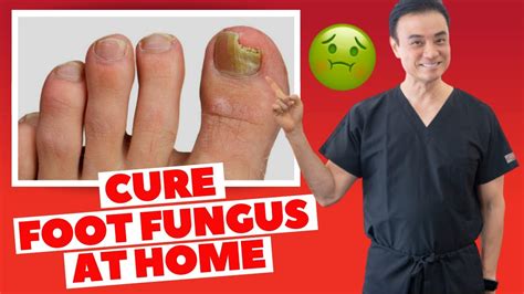 6 Effective Home Remedies To Cure Toenail Fungus Holistic Toenail
