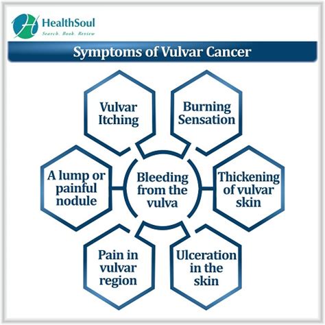 Vulvar Cancer Overview Symptoms Causes Diagnosis And Management Healthsoul