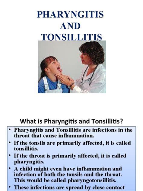 U 5 Pharyngitis And Tonsillitis Pdf Respiratory Diseases Public Health