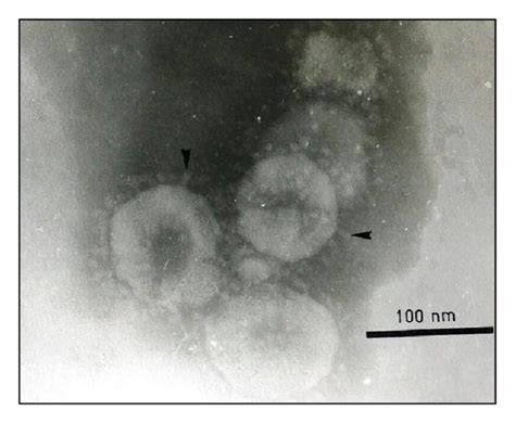Negative Staining Electron Microscope Showing Spherical Shape Of Virus