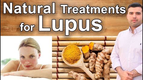 The Best Natural Treatments For Lupus What Few Know Youtube