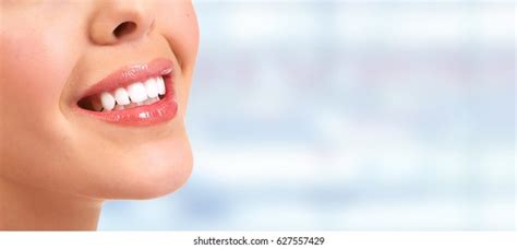 Laughing Woman Mouth Great Teeth Over Stock Photo 319728569 Shutterstock